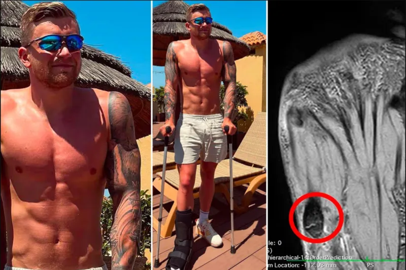 Adam Peaty từng trải qua chấn thương và giai đoạn khó khăn về tinh thần trước khi tìm lại cân bằng và động lực thi đấu.